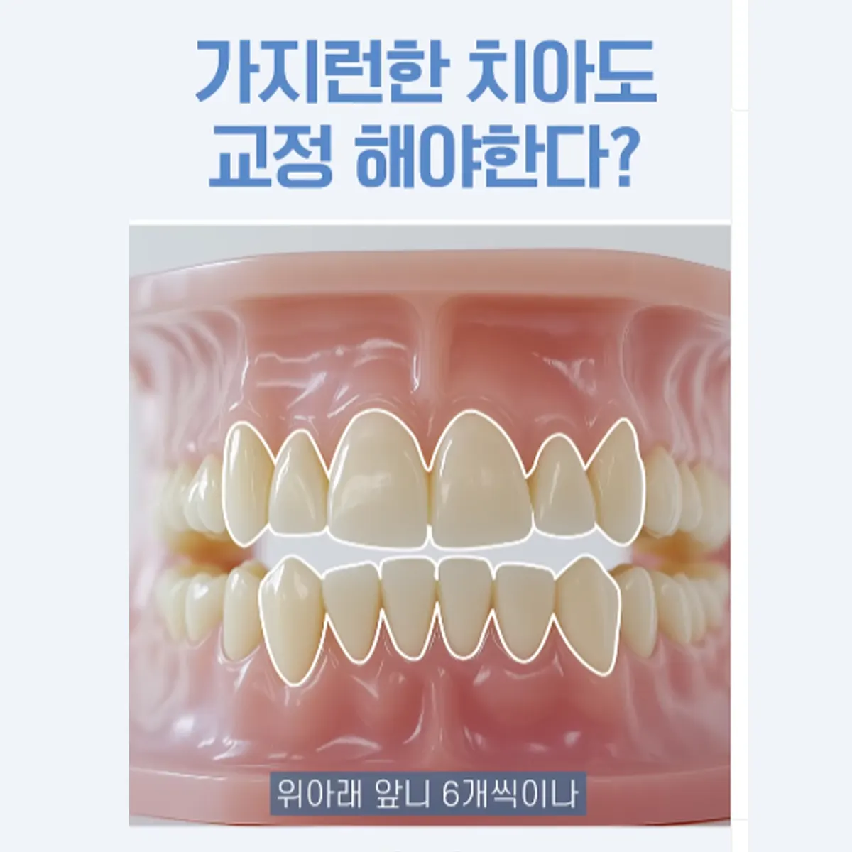 main insta03 — 루센트치과의원